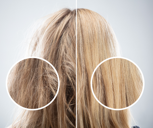 Do Scrunchies Reduce Hair Loss?